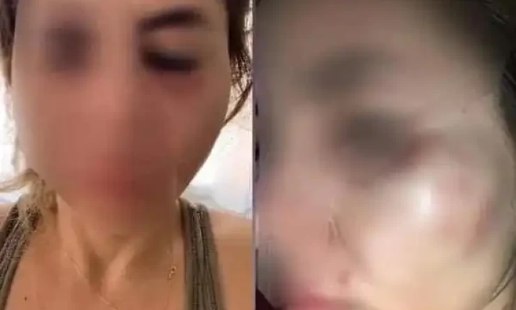 Mersin'de müzik öğretmenine sokakta saldırı